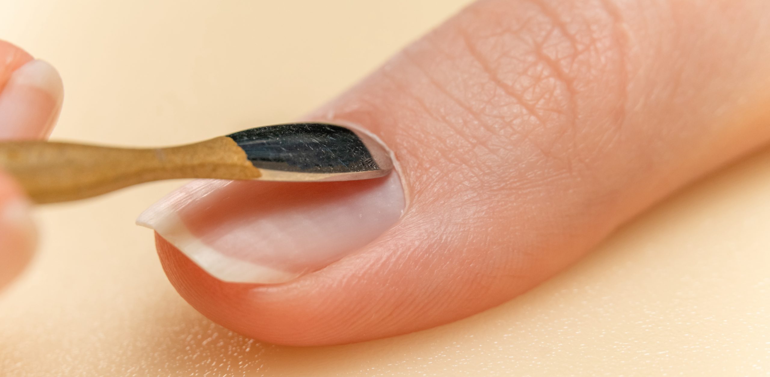 Why Are My Cuticles Turning Brown Design Talk